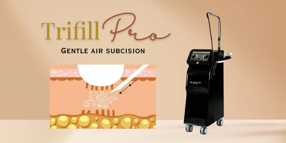 Air Subcision