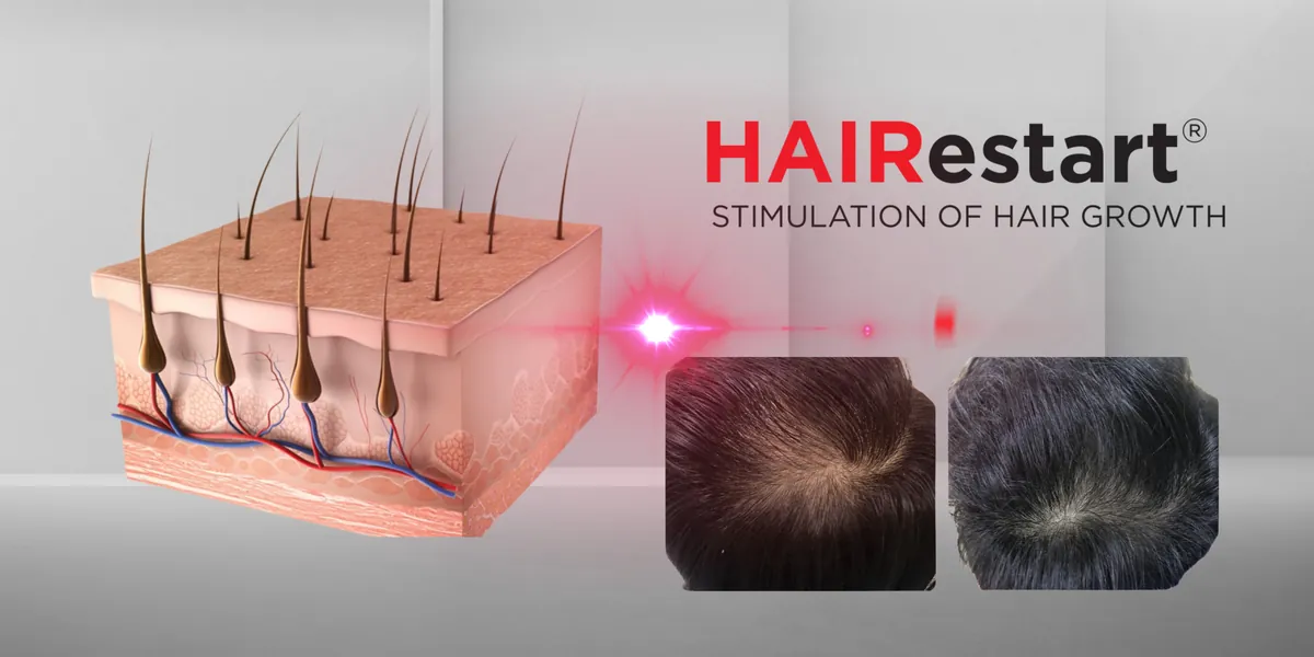 Hair Growth