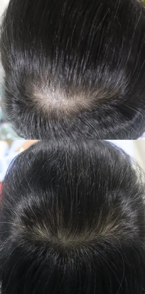 HAIRestart® Result 1
