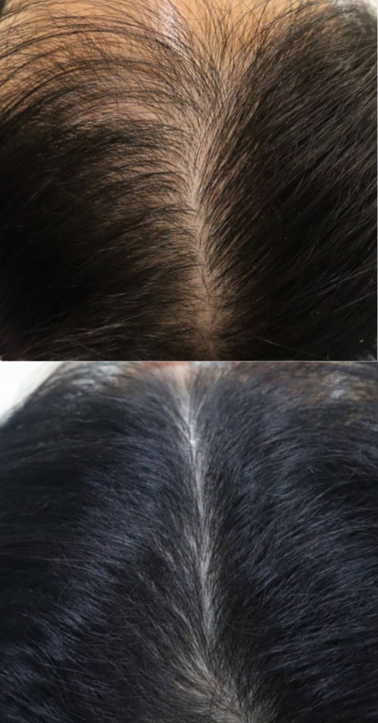 HAIRestart® Result 3